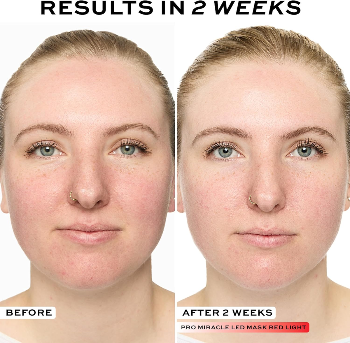 Miracle LED Face Mask, Red & Blue Skincare Light Therapy, 90 Bulbs, Anti-Ageing & Improves Skin Texture, for Radiant Glowing Skin